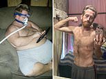 Obese man loses 350LBS without going to the gym
