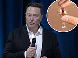 Elon Musk demonstrates his Neuralink implants brain-machine interface in PIGS