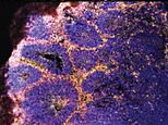 Coronavirus kills off BRAIN cells, study finds