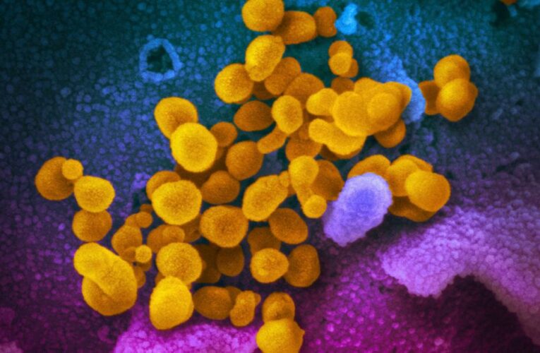 Scientist says early coronavirus samples were deleted from NIH database