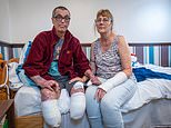Grandfather has to have BOTH legs amputated after pet dog bit him and he developed sepsis