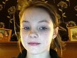 Drunken young woman who knocked a man unconscious in East Yorkshire is cleared of causing his death